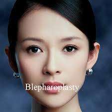 Gangnam Group Plastic Surgery